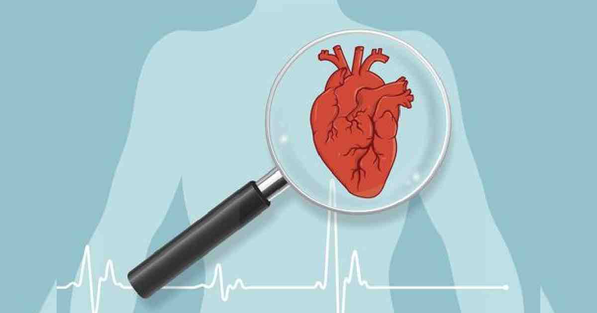 BBS , BBS data , Cardiac arrest deaths , Cardiac arrest deaths BD , Cardiac arrest Bangladesh , cardiac arrest